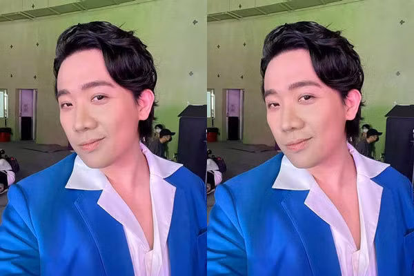  Trấn Thành đăng ảnh với gương mặt lạ lẫm kèm câu hỏi với người hâm mộ "Hôm nay có gì lạ nè?".