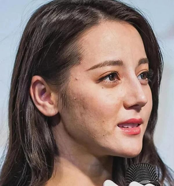 “Đoá hoa tân cương” luôn được các fan tôn vinh là quốc bảo nhan sắc của Trung Quốc cũng có lúc khiến công chúng thất vọng. Làn da khi được ống kính bắt cận của nữ diễn viên sinh năm 1992 lại trông không mấy mịn màng, mụn cám xuất hiện nhiều và độ đàn hồi của da cũng phần nào sụt giảm.