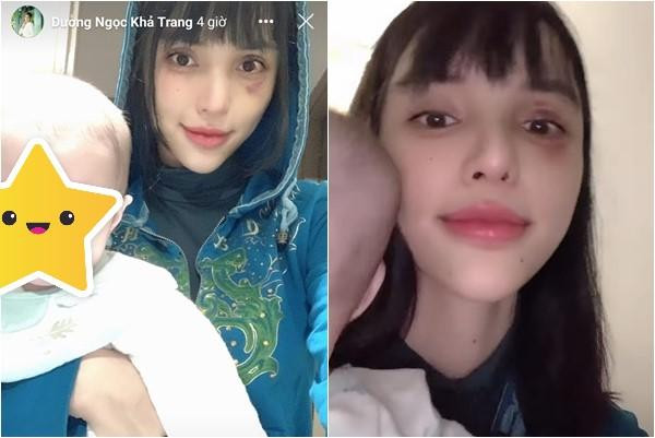 Dù thần thái có phần tươi tắn, song những "tàn tích" của vụ bạo hành vẫn còn trên gương mặt chân dài. Vùng mặt Khả Trang vẫn sưng, mắt còn máu tụ.