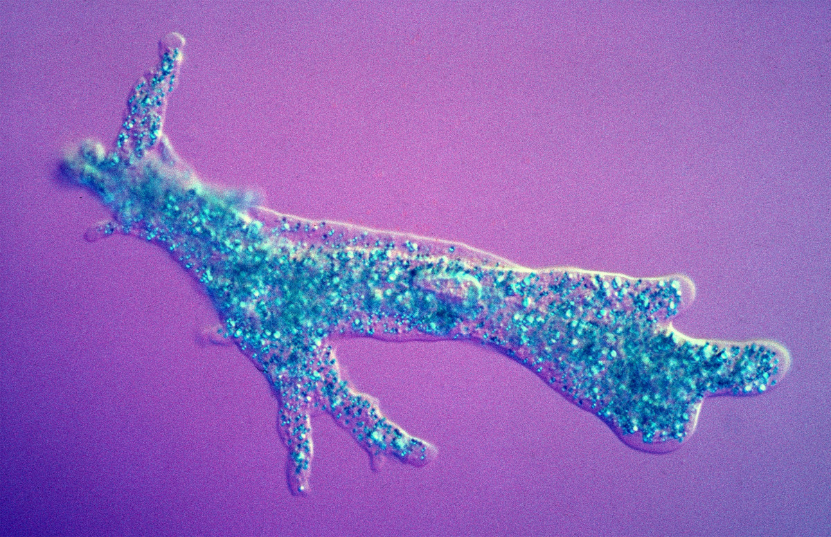 Tuy một số sinh vật dễ xác định là sinh vật sống, nhưng ranh giới giữa sinh vật sống và vô tri rất khó phán đoán vì nhiều sinh vật và cấu trúc hữu cơ. Tuy nhiên, một số đặc trưng chính có thể xác định một số sinh vật sống như khả năng hoạt động, phát triển, thay đổi, sửa chữa và sinh sản. Trong ảnh là trùng amíp (sinh vật nhân sơ đơn bào - dạng sống đơn giản và nguyên thủy nhất) có thể phân đôi, cả hai tế bào đều có thể ăn và trưởng thành rồi lại chia đôi, tất cả chỉ trong vài giờ đồng hồ. Nguồn: biodiversity4all.