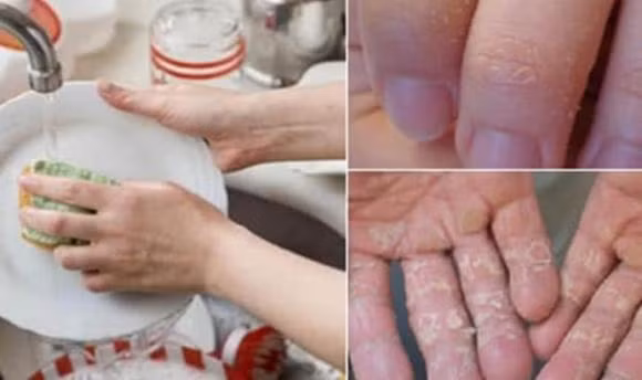 Rua bat bang tay nen tranh 6 sai lam keo ton tien hai da