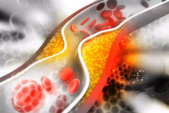 An qua nhieu long do trung co thuc su gay ra du thua cholesterol?-Hinh-2