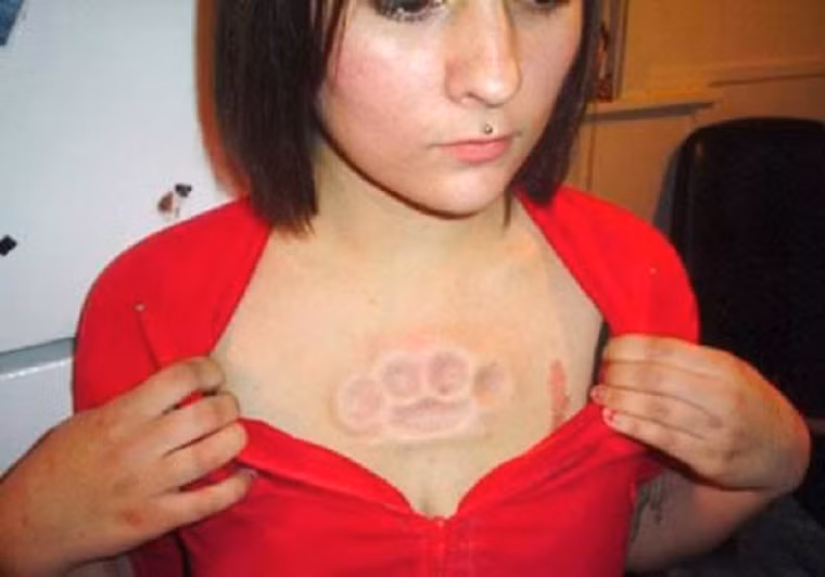 Cô gái này thậm chí còn làm chìm những chiếc khuyên vòng vào dưới da ngực của mình
