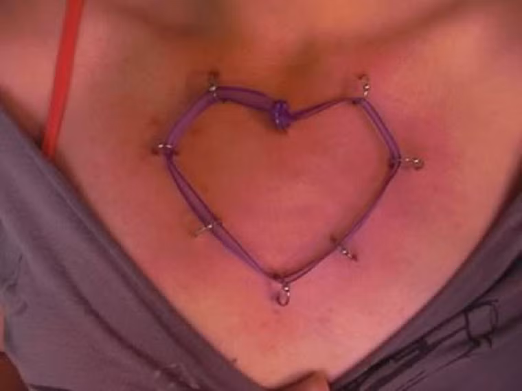 Không thỏa mãn với trái tim tong lồng ngực, họ tìm cách găm những chiếc móc tròn với dây tạo thành hình trái tim nổi trên ngực