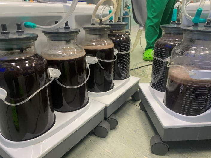 Mang khoi u khung, du hoc sinh tro ve Viet Nam cap cuu-Hinh-2