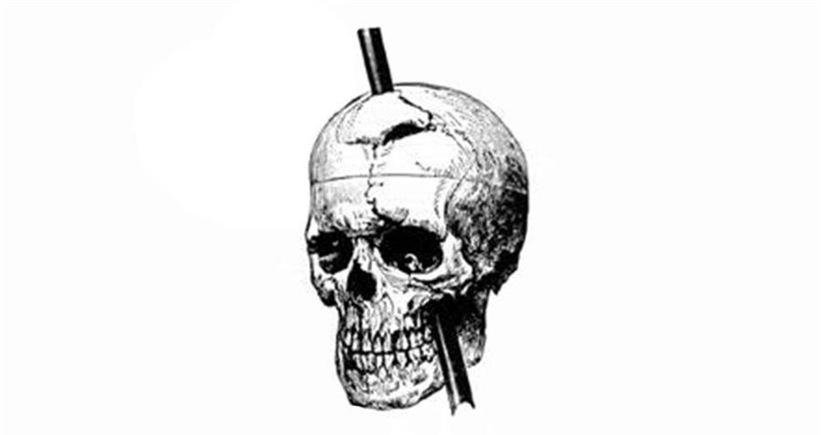 Phineas Gage va vu tai nan khai sinh ra khoa hoc than kinh hien dai-Hinh-2