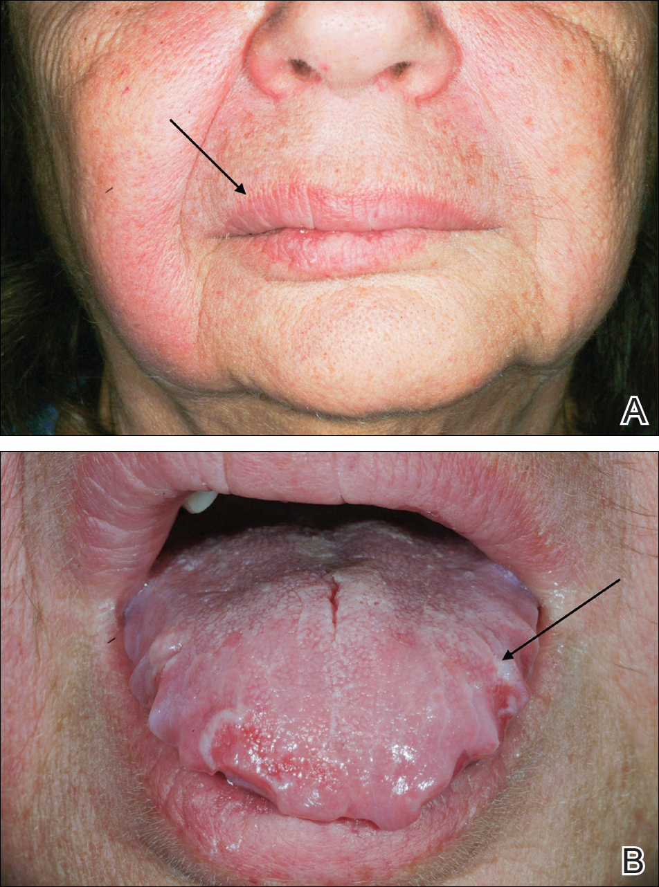 Kinh hoang can benh khien nguoi mac mang 