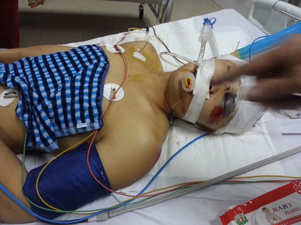 Theo lời một nạn nhân cho biết, lái xe đâm các nạn nhân đã bỏ trốn sau khi đưa các nạn nhân đi cấp cứu.