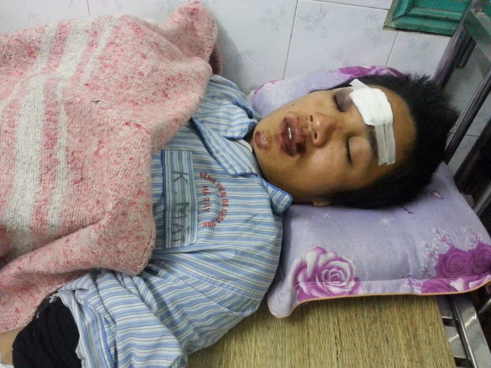 Các nạn nhân đang được điều trị trong tình trạng nguy kịch.