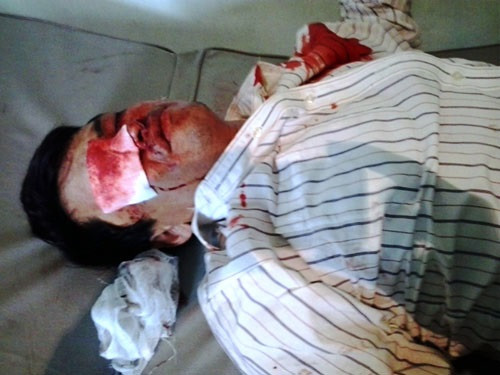 Một người dân bị thương khi làm việc với công an.