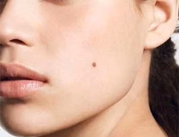 Hầu hết mọi người đều có nốt ruồi trên mặt, và nốt ruồi cũng thể hiện những ý nghĩa khác nhau về nhân tướng học.