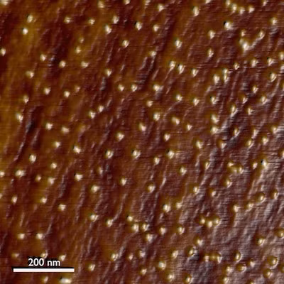 Hình ảnh tơ nhện độc nâu dưới ống kính hiển vi lực nguyên tử.