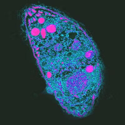 Ký sinh trùng Toxoplasma gondii là động vật ký sinh đơn bào, người bị nhiễm không có triệu chứng và không bao giờ biết họ đang bị nhiễm bệnh, đối với phụ nữ mang thai ký sinh trùng có thể đi qua nhau thai và gây ra dị dạng ở thai nhi, thậm chí sẩy thai.
