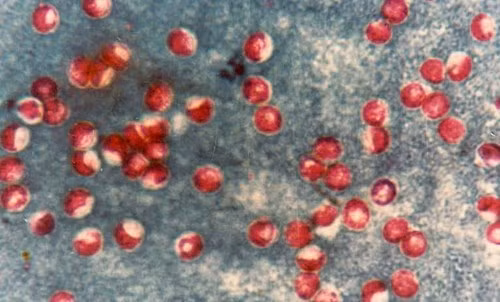 Ký sinh trùng Cryptosporidium spp, truyền qua nước bị ô nhiễm hoặc thực phẩm được rửa bởi nước bị ô nhiễm. Ký sinh trùng này gây tiêu chảy nghiêm trọng.