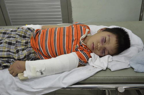 Cháu Hiếu với thương tích nghiêm trọng được gia đình đưa vào bệnh viện cấp cứu.