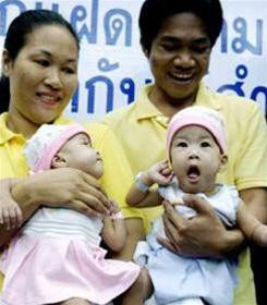 Tuy nhiên, sau đó ca mổ tách rời 2 bé đã thành công tốt đẹp tại một bệnh viện Siriraj ở Thái Lan. Theo các bác sĩ ở bệnh viện này, hiện trên thế giới mới ghi nhận duy nhất một trường hợp dính liền phức tạp như vậy được tách rời thành công.