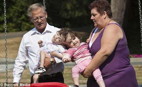 Hai bé gái này có hai cơ thể riêng biệt nhưng chỉ có chung 1 bộ não. Trường hợp dính đầu như hai bé gái Krista và Tatiana vô cùng hiếm gặp. Chỉ có 8 ca tương tự trên thế giới được ghi nhận từ trước tới nay và chỉ 3 trong số những cặp sinh đôi dinh đầu này sống sót sau khi chào đời.