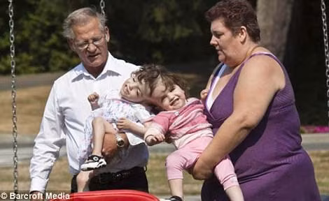 Hai bé gái này có hai cơ thể riêng biệt nhưng chỉ có chung 1 bộ não. Trường hợp dính đầu như hai bé gái Krista và Tatiana vô cùng hiếm gặp. Chỉ có 8 ca tương tự trên thế giới được ghi nhận từ trước tới nay và chỉ 3 trong số những cặp sinh đôi dinh đầu này sống sót sau khi chào đời.