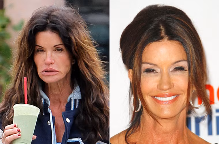 Siêu mẫu một thời Janice Dickinson trông chẳng khác hành khất khi ra đường với bộ dạng đầu bù tóc rối và gương mặt nhàu nhĩ vì thiếu trang điểm.