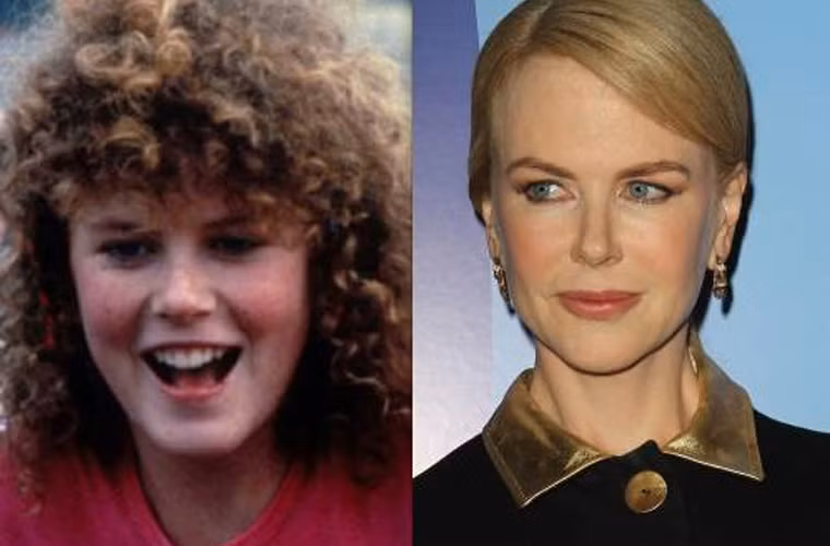 Mái tóc xù bông, khuôn mặt lốm đốm tàn nhang không điểm nhấn, Nicole Kidman của thời xưa ấy không thể so sánh với sắc đẹp hiện tại của một ngôi sao hạng A Hollywood bây giờ.