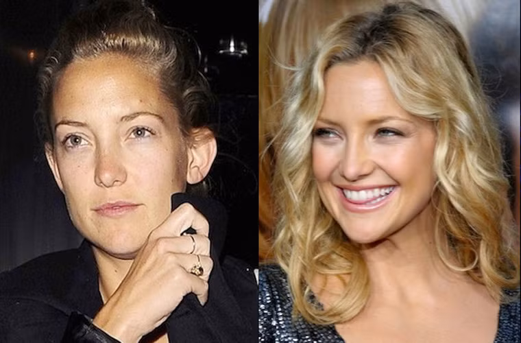Khuôn mặt xinh xắn ưa nhìn của Kate Hudson mỗi khi xuất hiện trên thảm đỏ biến mất thay và chẳng còn ai nhận ra cô là ngôi sao Hollywood trong bộ dạng đầu tóc rối bời, mặt mũi không trang điểm.
