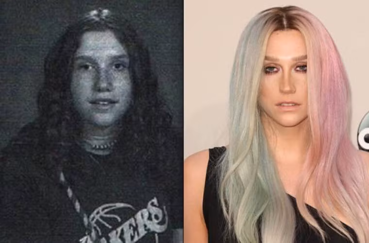 Ke$ha ngày xưa so với bây giờ đúng là một trời một vực.
