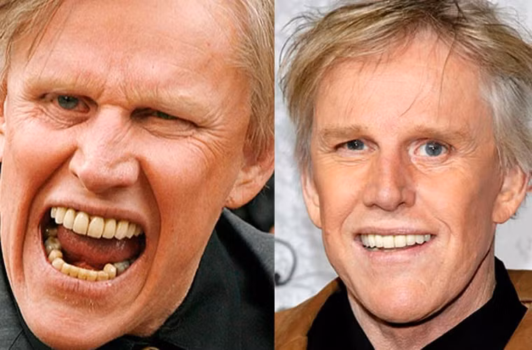 Bọc sứ toàn bộ hàm răng là điều thông minh nhất mà Gary Busey làm với bản thân mình.