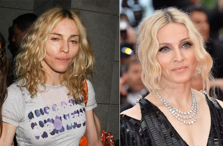 55 tuổi, nên Madonna cũng nhăn nhúm, xấu xí khi không được makeup cẩn thận.