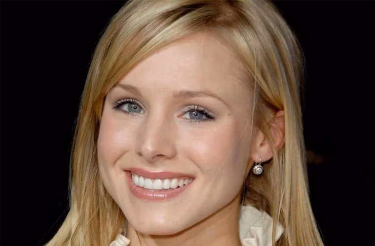 Vẻ xinh tươi của Kristen Bell bị mất điểm phần nào vì đôi mắt lác.