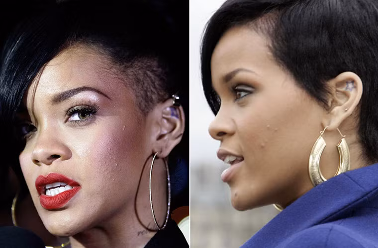 Trái với hình ảnh nuột nà mà Rihanna hay khoe trên các trang xã hội, khi chụp cận cảnh, Rihanna cũng lộ nhược điểm mặt đầy mụn.