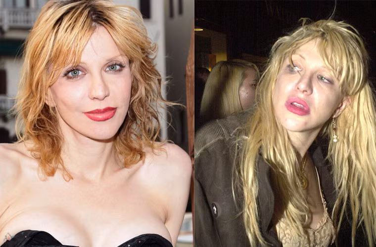 Courtney Love từng công khai mình nghiện ma túy và phải khổ sở cai nghiện ra sao. Cô sử dụng heroin ngay cả khi đang mang thai và ngoài ra còn dùng thêm cả ecstasy và cocaine. Nghiện ma túy nặng đã khiến vẻ ngoài của nữ ca sĩ tàn tạ nhanh chóng.