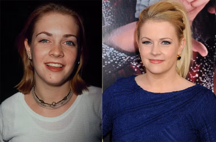 Bên mắt trái của Melissa Joan Hart to hơn hẳn mắt phải của cô.