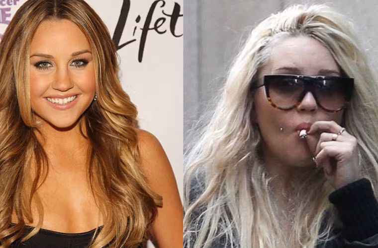Nữ diễn viên người Mỹ Amanda Bynes từng phủ nhận sử dụng ma túy cho tới khi những bức ảnh paparazzi chụp cô lúc say sưa cocaine được tung ra. Đó là lý do tại sao thời gian gần đây Amanda thường có hành động và vẻ ngoài rất kỳ lạ khác hẳn với hình ảnh đáng yêu thuở nào.