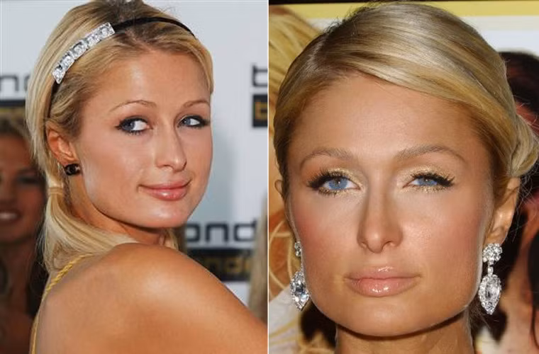 Đôi mắt xanh biếc của Paris Hilton khi nhìn gần hóa ra lại một bên mắt to, một bên mắt nhỏ.