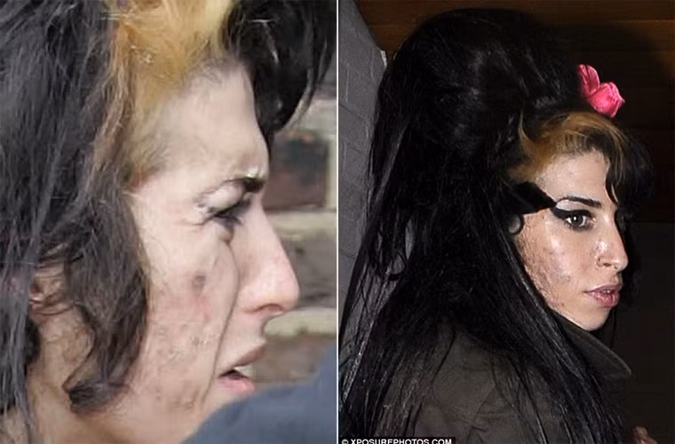 Ma túy, rượu, lối sống phóng túng đã phá nát khuôn mặt nữ ca sĩ Winehouse.