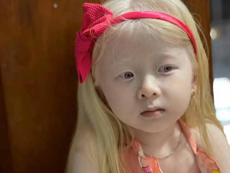 Hai lan sinh con dac biet cua vo chong Rong - May o Soc Trang-Hinh-4