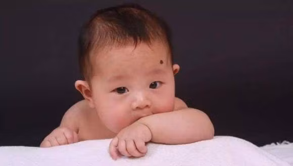 Tre em co not ruoi o vi tri nay la bieu tuong cua “phuoc lanh