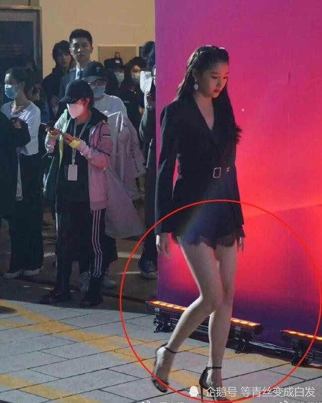 Soc voi doi chan sieu nho cua Quan Hieu Dong ngoai doi-Hinh-6