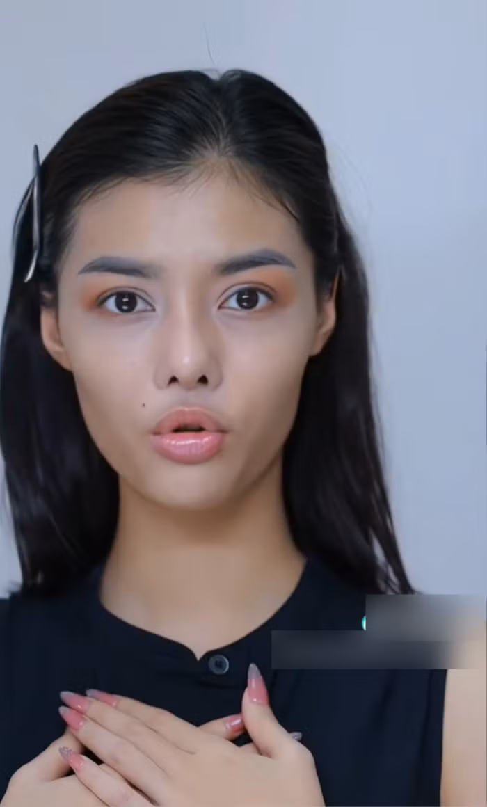 Netizen tiec nuoi khi nhin nhan sac A hau Kieu Loan hau phau thuat