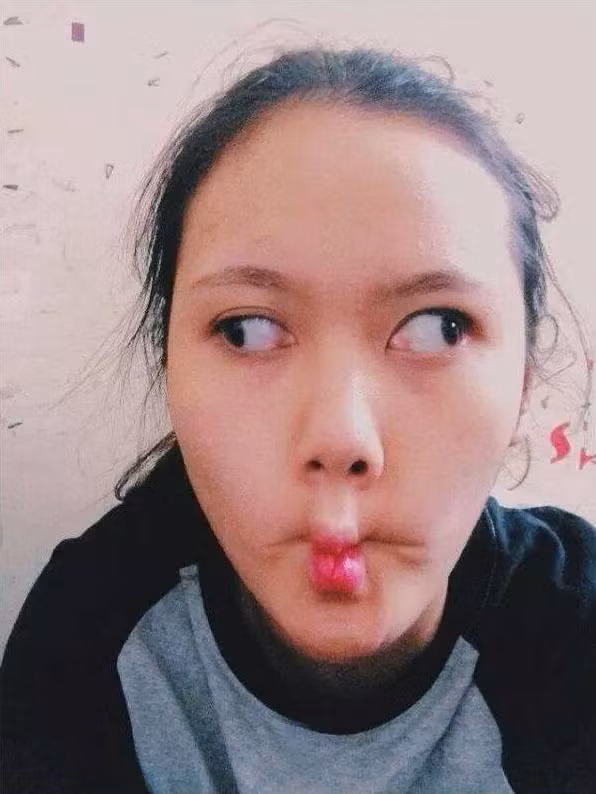 Các cô gái cố gắng đảo tròng mắt của mình để người xem có cảm giác như đôi mắt bị lác thực sự. Kèm theo đó là một vài cử chỉ ngộ nghĩnh khác để tạo nên bức ảnh vừa ngộ nghĩnh vừa quái gở.