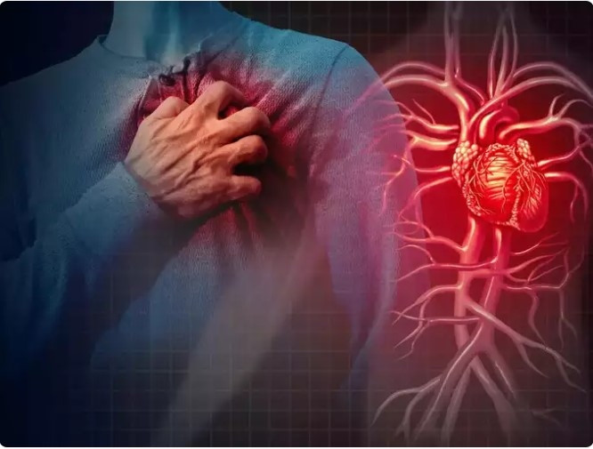 Có thể giảm tắc nghẽn động mạch? Theo chuyên gia, có thể ngăn ngừa cũng như đẩy lùi các bệnh tim mạch và tắc nghẽn bằng cách áp dụng một số biện pháp lành mạnh và bền vững, yêu cầu loại bỏ một số loại thực phẩm, tập thể dục và yoga. Ngoài ra, các chuyên gia sức khỏe còn gợi ý 5 loại thực phẩm phổ biến có tác dụng giảm tắc nghẽn động mạch. Đây là tất cả những gì bạn cần làm theo để đẩy lùi bệnh tim.