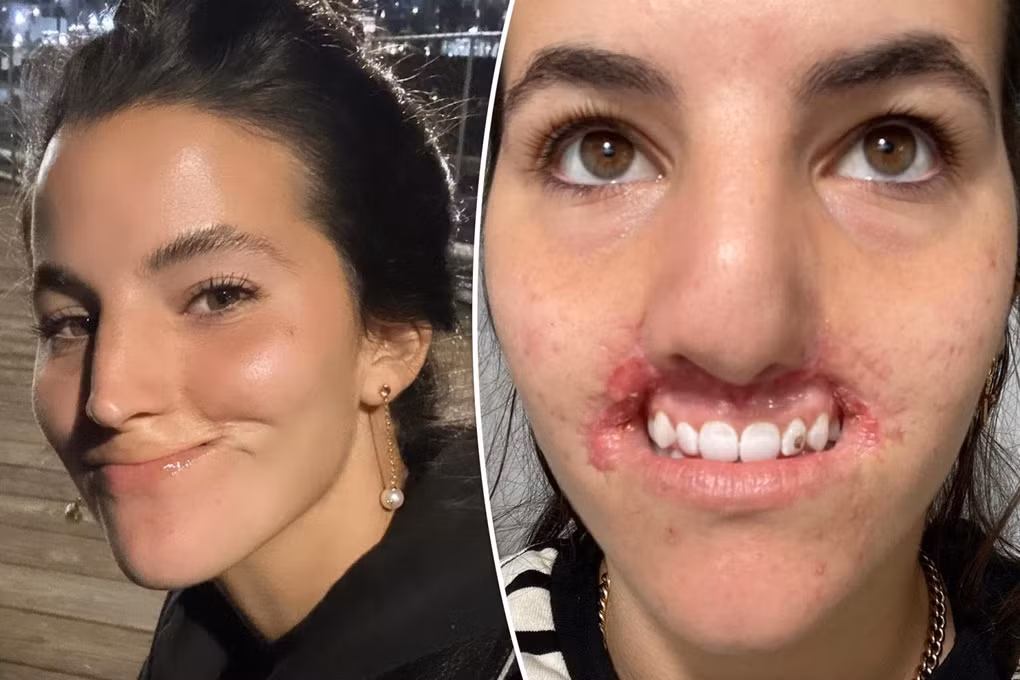 Nguoi mau mat toan bo moi tren vi bi cho du tan cong