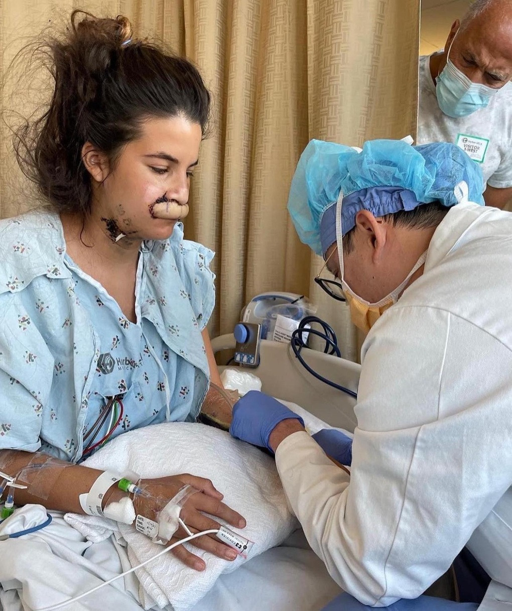 Nguoi mau mat toan bo moi tren vi bi cho du tan cong-Hinh-2