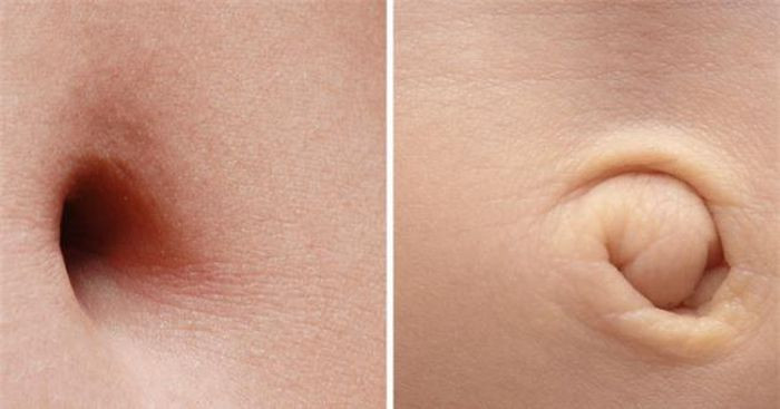 3. Rốn của mỗi người là độc nhất vô nhị. Rốn của mỗi người hoàn toàn khác nhau không chỉ bởi sự khác biệt về hình dạng bên ngoài mà còn là những thứ được chứa đựng bên trong. Đó chính là vi khuẩn. Có khoảng 2.400 loài vi khuẩn khác nhau đã được tìm thấy trong rốn con người. Và trong rốn mỗi người có chứa đựng vi khuẩn không hề giống nhau. Người ta đã từng tìm thấy loài vi khuẩn “độc quyền” tại các mẫu đất của Nhật Bản trong rốn của một người đàn ông. Điều đặc biệt là người đó… chưa đến Nhật Bản bao giờ.