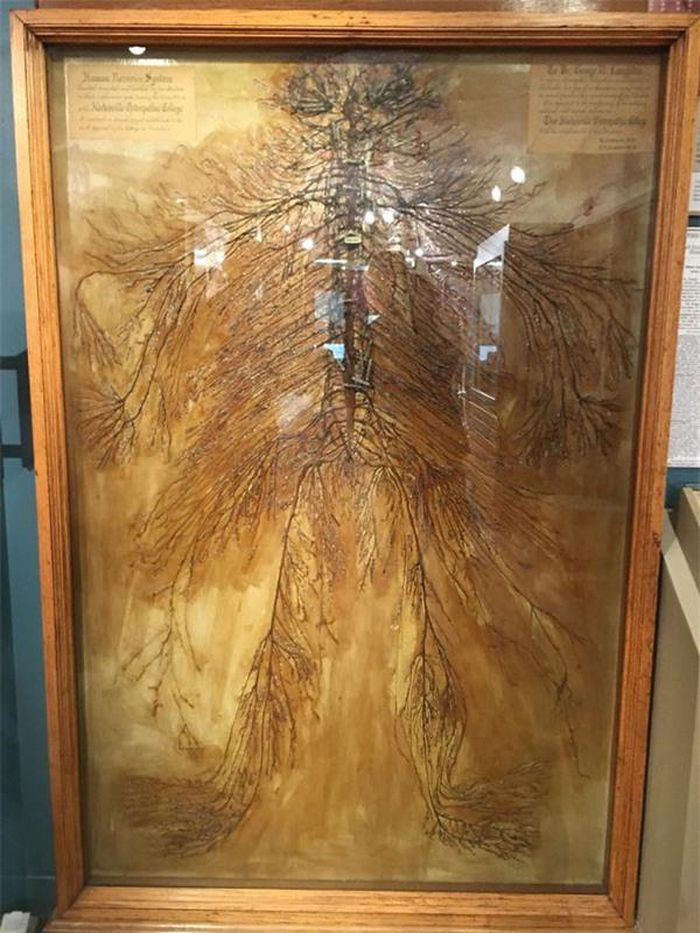 Hệ thần kinh nguyên vẹn của con người (từ não đến chân) có hình dạng như hình dưới đây.