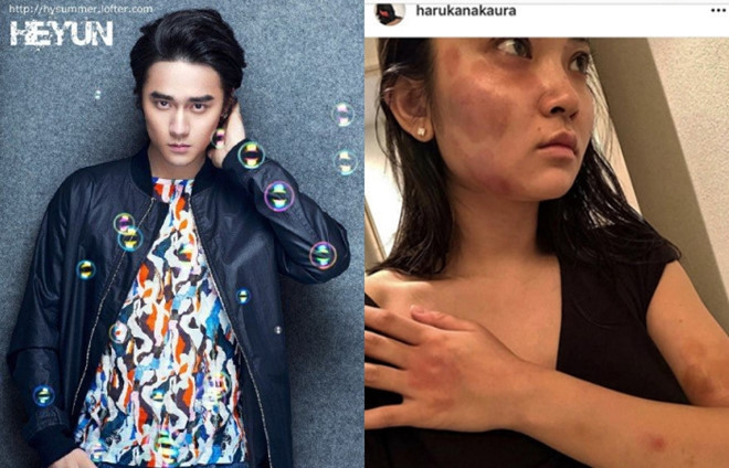 Tai tu Trung Quoc bi to bao hanh 