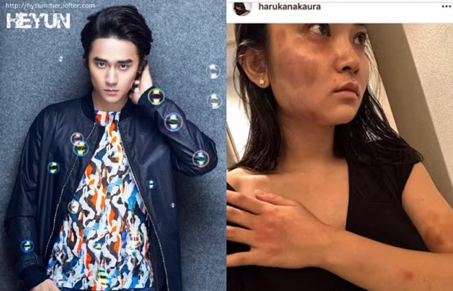 Tai tu Trung Quoc bi to bao hanh 