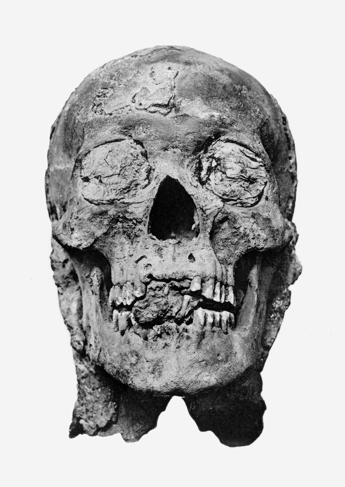 Các khảo sát thực hiện trên xác ướp cho thấy, trong những năm cuối đời, Amenhotep III đã phải sống trong sự dày vò của nhiều loại bệnh tật khác nhau.