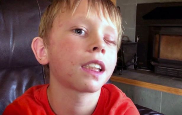 Be 8 tuoi chong bao su tu vo bang tay khong ngay truoc nha