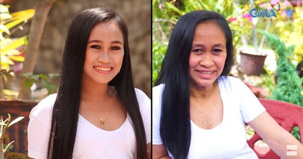 Can benh ky la khien co gai 16 tuoi trong nhu ba lao 60